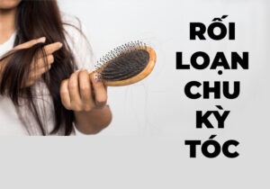 roi loan chu ky toc