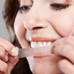 3 lí do bạn nên chọn miếng dán trắng răng cho một hàm răng chuẩn “celeb”