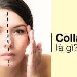 Cùng Đẳng Cấp Phái Đẹp “nghía” qua các dấu hiệu thiếu hụt collagen.