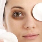 9 cách “siêu dễ” giúp trị thâm quầng mắt, bọng mắt cực nhanh
